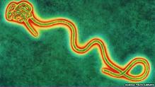 Suspicion d'un cas d'Ebola